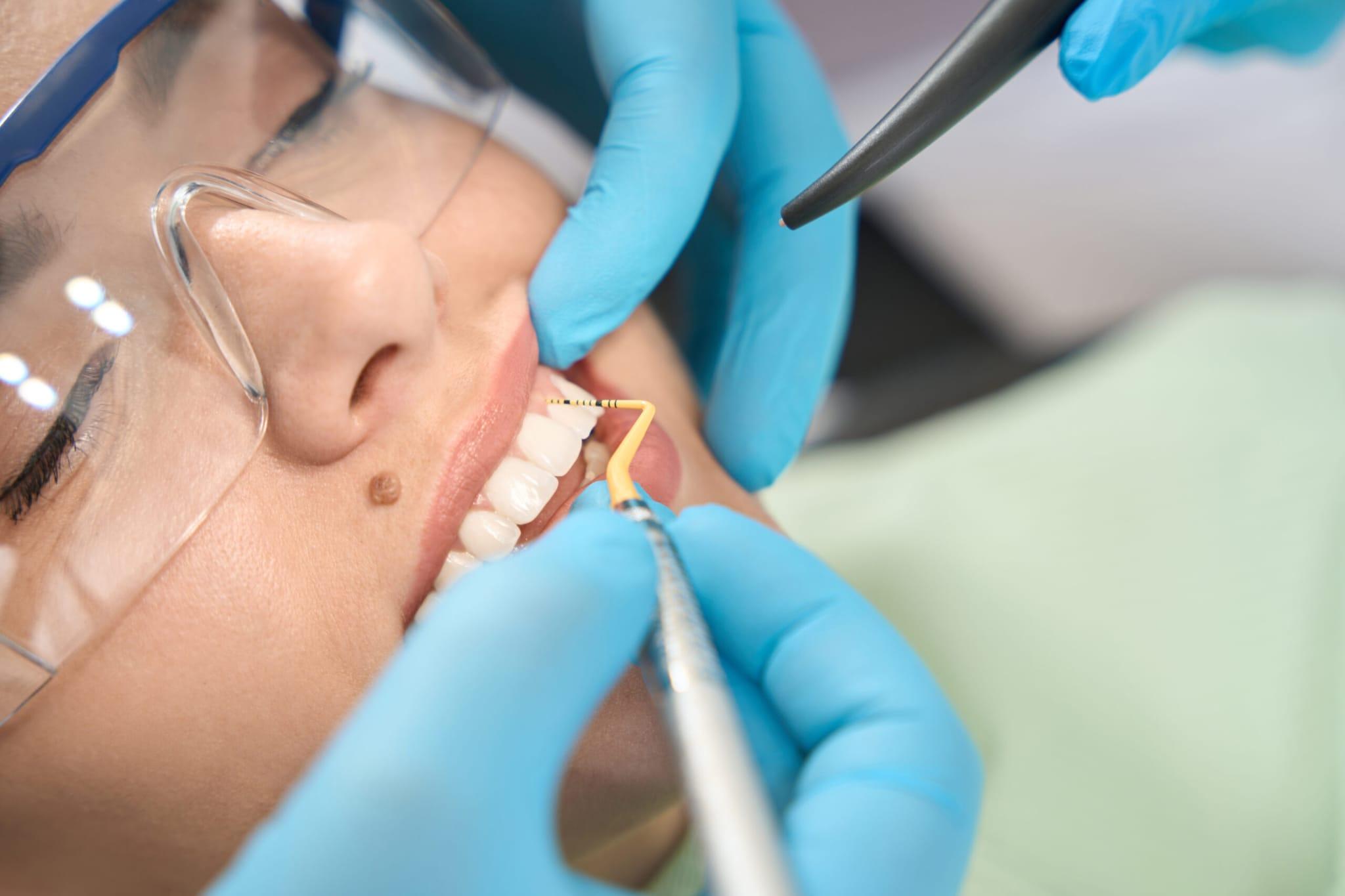 Gum Disease: Causes and Prevention