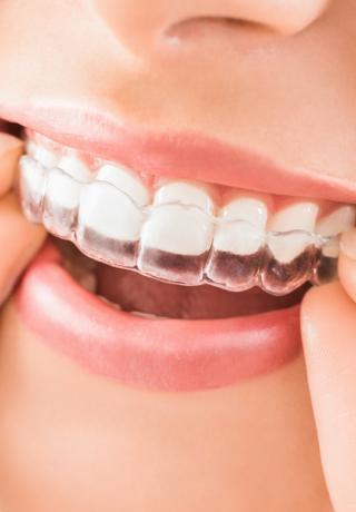 Orthodontics: Beyond Straight Teeth